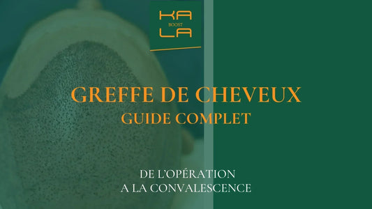 Guide complet sur la greffe de cheveux : de l’opération à la repousse – Kalaboost