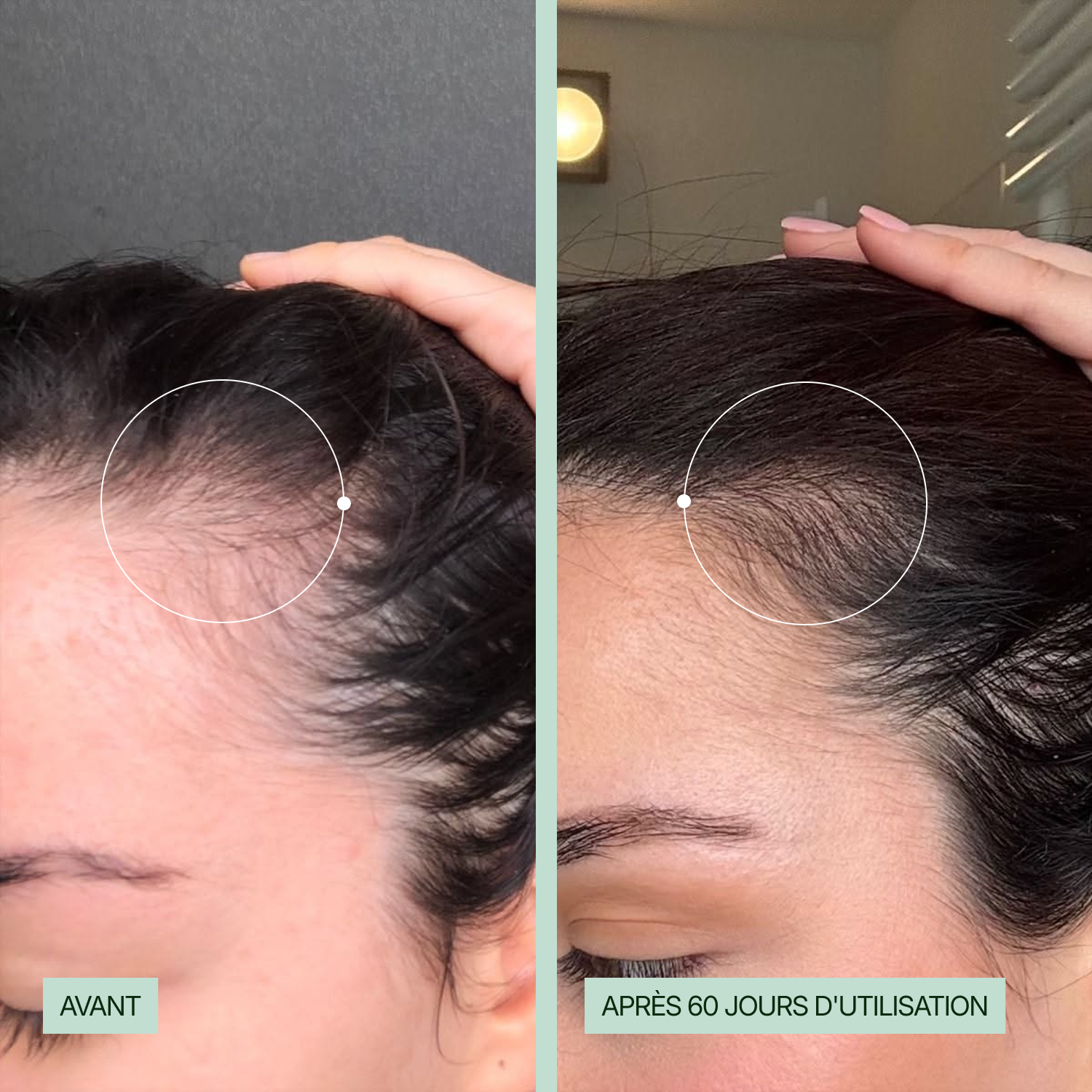 Complément alimentaire cheveux Kalaboost – Hair Boost plantes & zinc KALABOOST