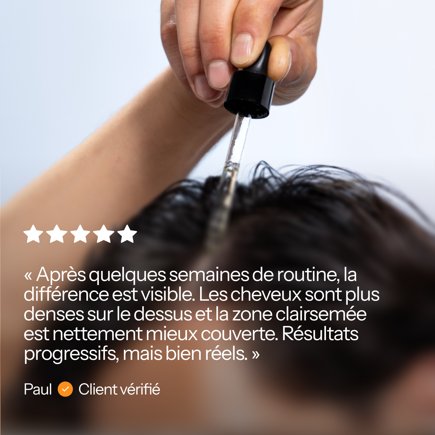 Hair Boost Routine KALABOOST