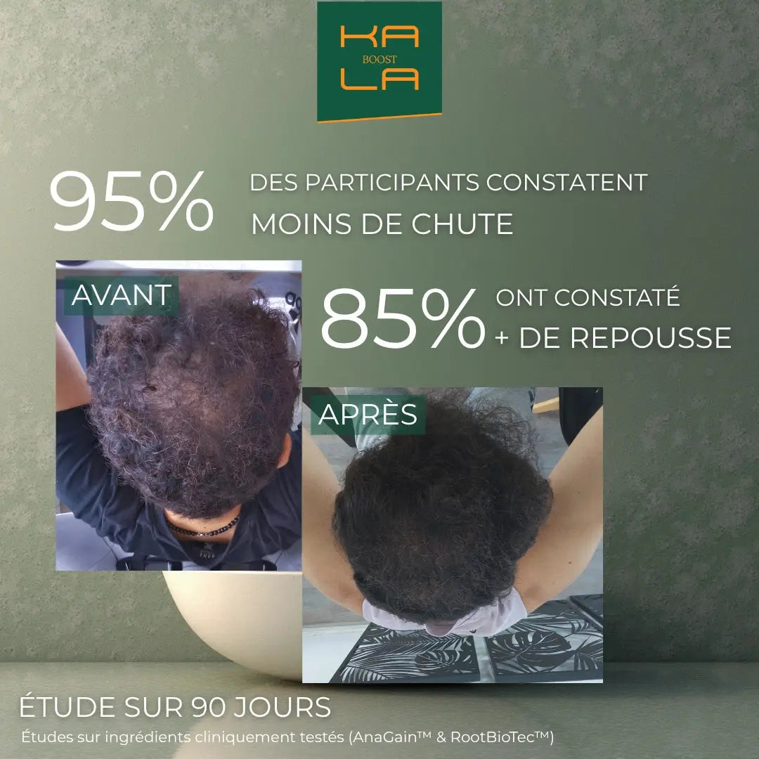 PACK EXPERT REPOUSSE – STOPPE LA CHUTE & BOOSTE LA REPOUSSE KALABOOST