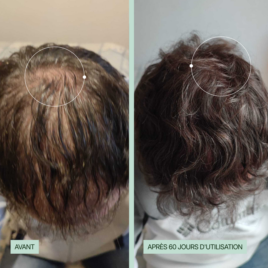 Shampoing Anti-Chute KALABOOST