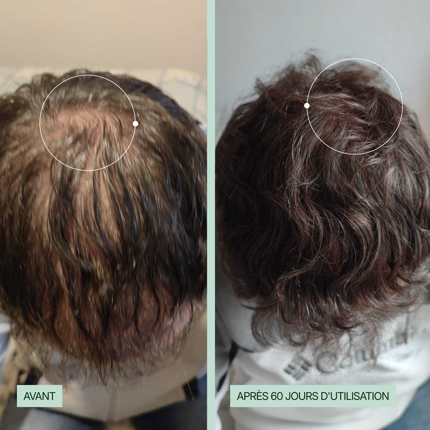 Shampoing Anti-Chute KALABOOST