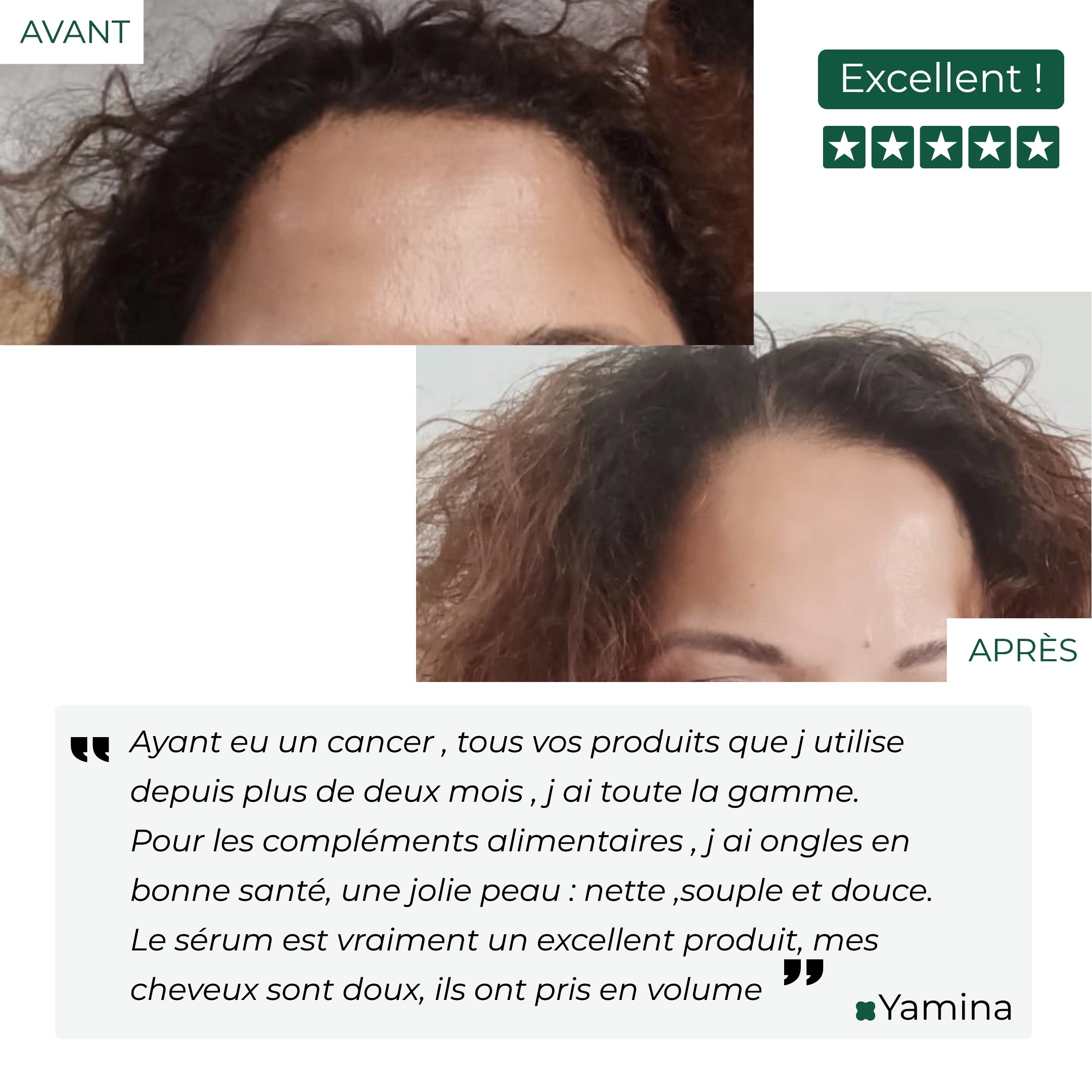 photo avant après l'utilisation des soins kalaboost 