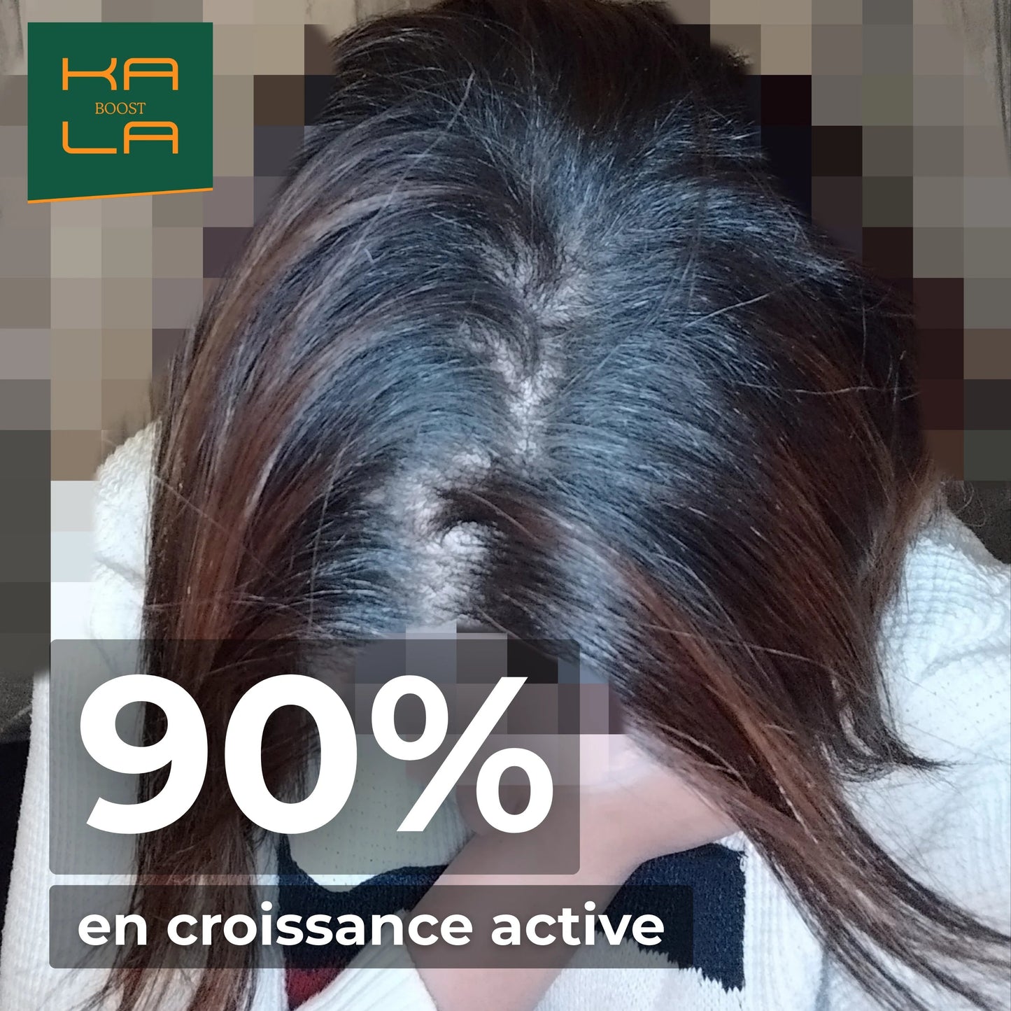 PACK EXPERT REPOUSSE – STOPPE LA CHUTE & BOOSTE LA REPOUSSE KALABOOST