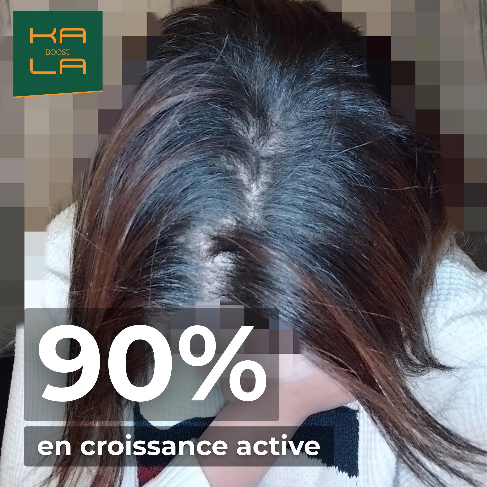 PACK EXPERT REPOUSSE – STOPPE LA CHUTE & BOOSTE LA REPOUSSE KALABOOST